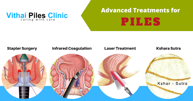 piles, advanced treatments for piles, piles specialist doctor in Pune,  Piles specialist in pune, kshara sutra treatment, Laser treatment for piles, Infrared coagulation, Stapler surgery, Stapled hemorrhoidectomy