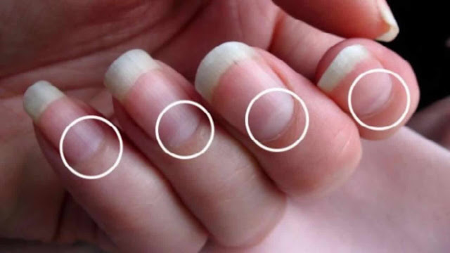 half moons on the nails reveal about health