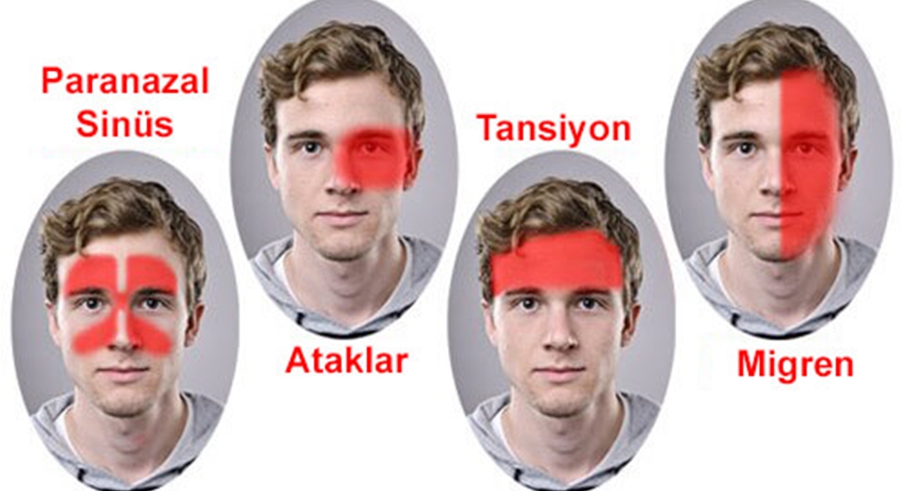 ne varsa dogada var migren agrilarini