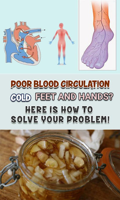 8 NATURAL SOLUTIONS FOR POOR BLOOD CIRCULATION OR COLD FEET AND HANDS