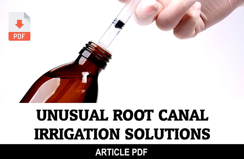 PDF Unusual Root Canal Irrigation Solutions