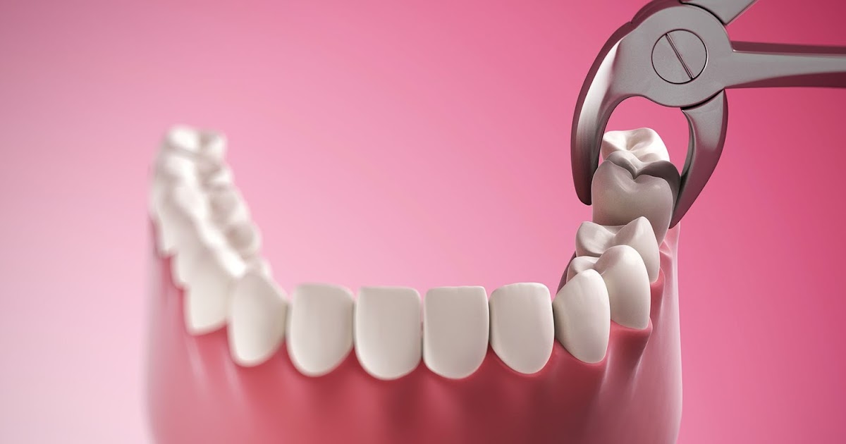 What are Different Types of Dental Surgery Performed by the Dentists