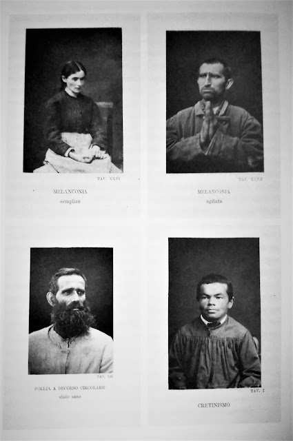 Tables by A. Tebaldi. Physiognomies and expressions studied in their deviations, 1884