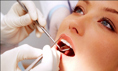 Kỹ thuật niềng răng có làm răng yếu đi