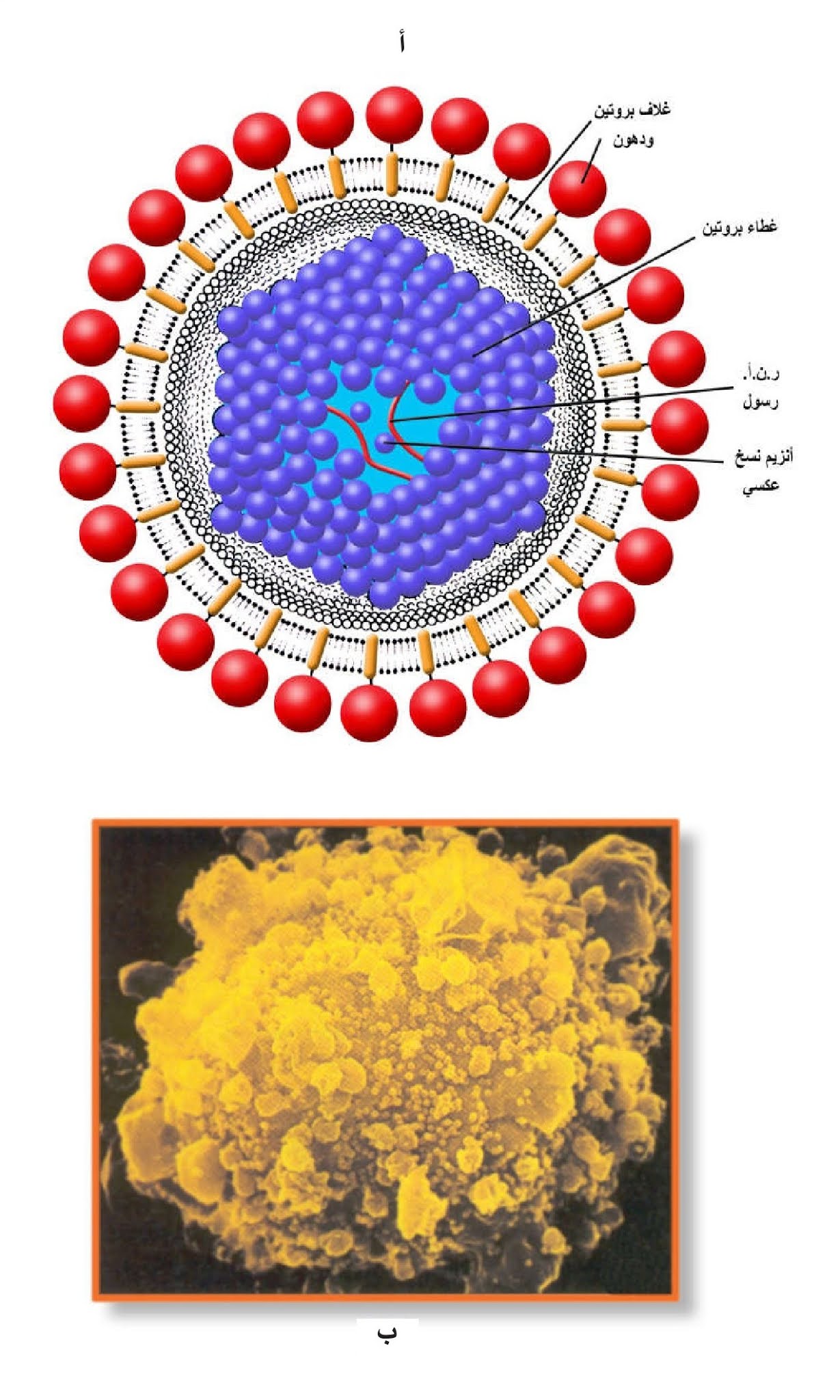 الشكل 21-28: أ) الفيروس المسبب لتناذر نقص المناعة المكتسبة، ب) خلية ليمفية مصابة بالفيروس والنقاط الصغيرة الخضراء التي على سطحها تمثل الفيروسات.