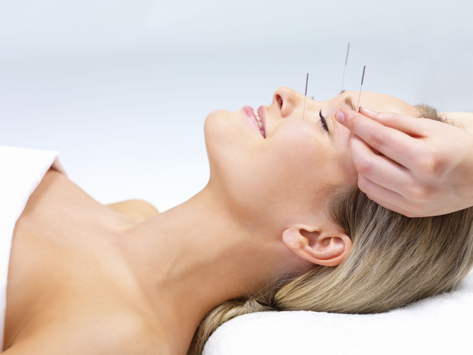 My thoughts on acupuncture