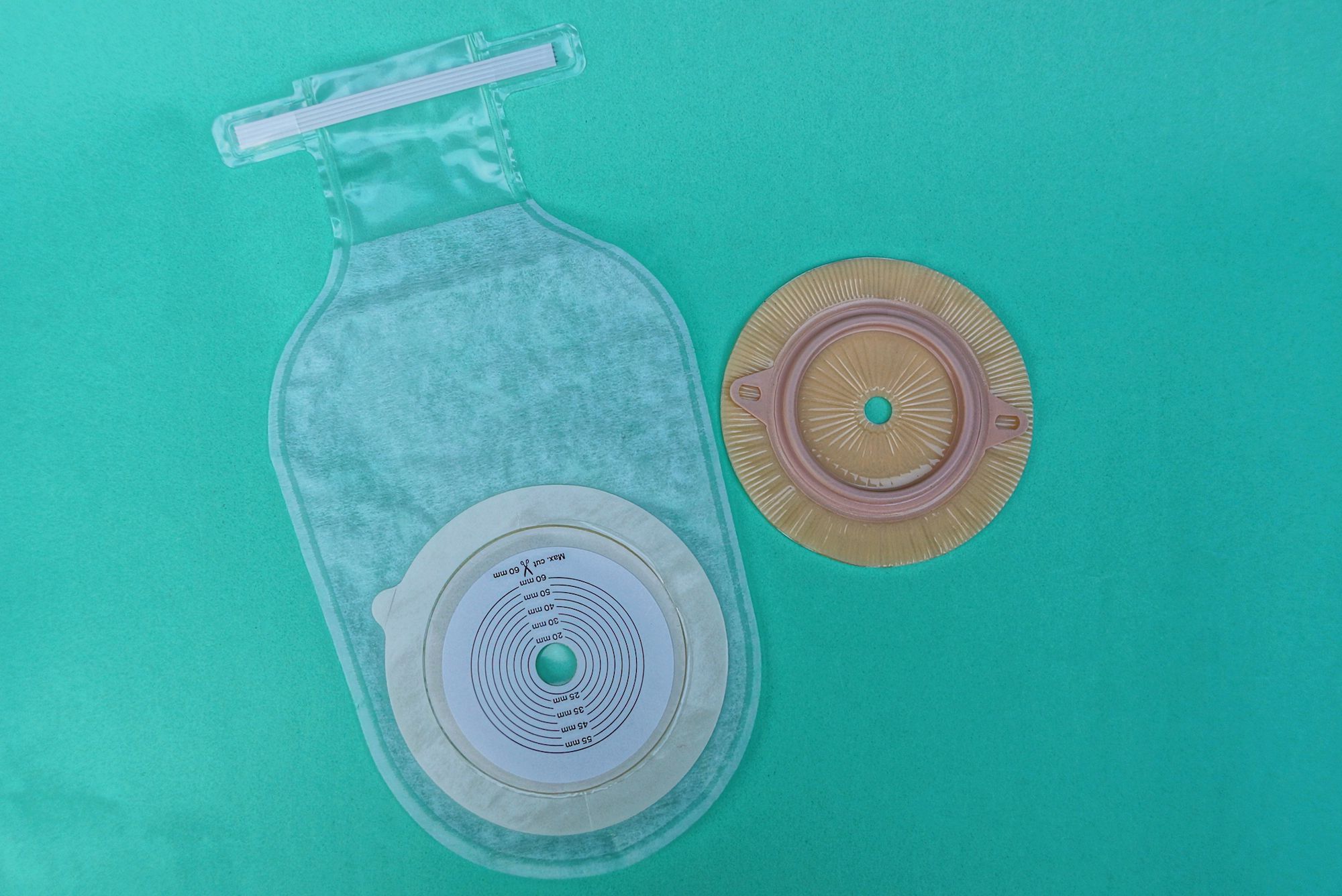 Emergent Ostomy Life How a JPouch can Make Your Life Noraml Again