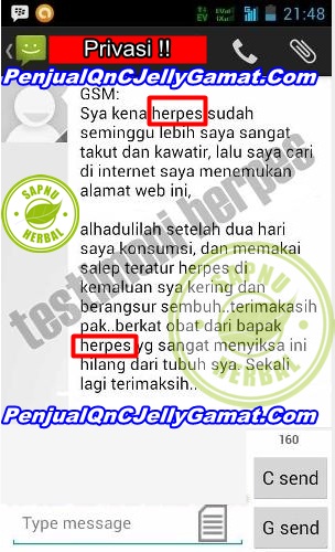 Cara Mengobati Penyakit Kulit Herpes Secara Alami Sampai Tuntas ~ TESTIMONI QNC JELLY GAMAT Cara Mengobati Penyakit Kulit Herpes Secara Alami Sampai Tuntas ~ TESTIMONI QNC JELLY GAMAT