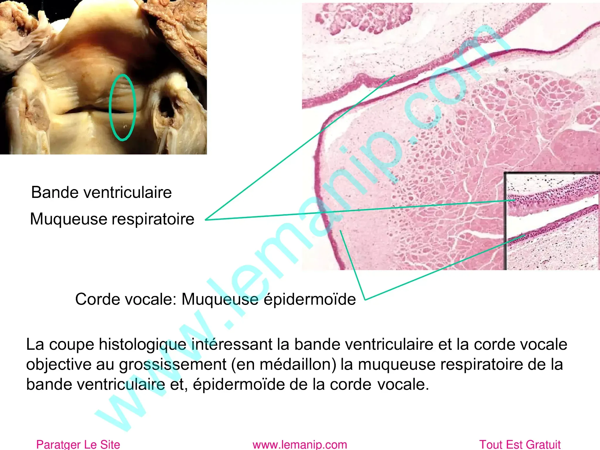 Bande ventriculaire Muqueuse respiratoire Muqueuse respiratoire