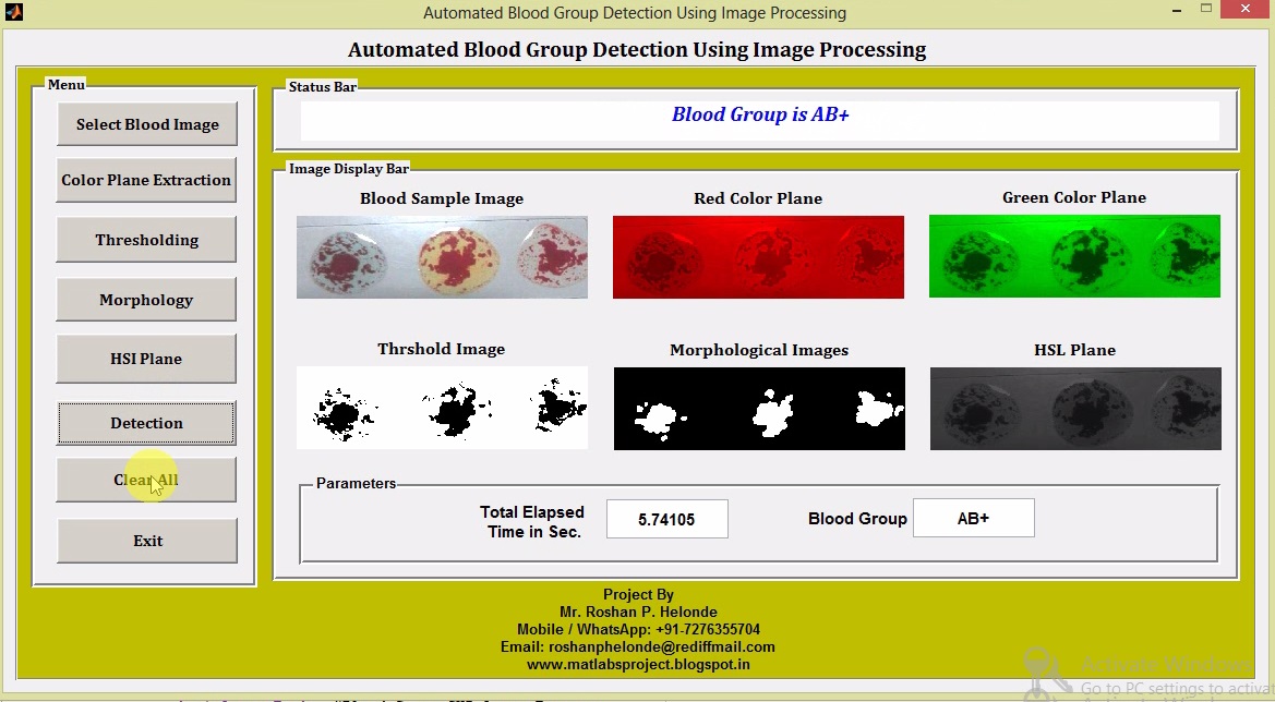 Blood Group Detection Using Image Processing Matlab Project with Source ...