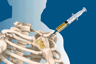 treatment of bone cancer