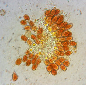 Arthuriomyces peckianus aeciospores