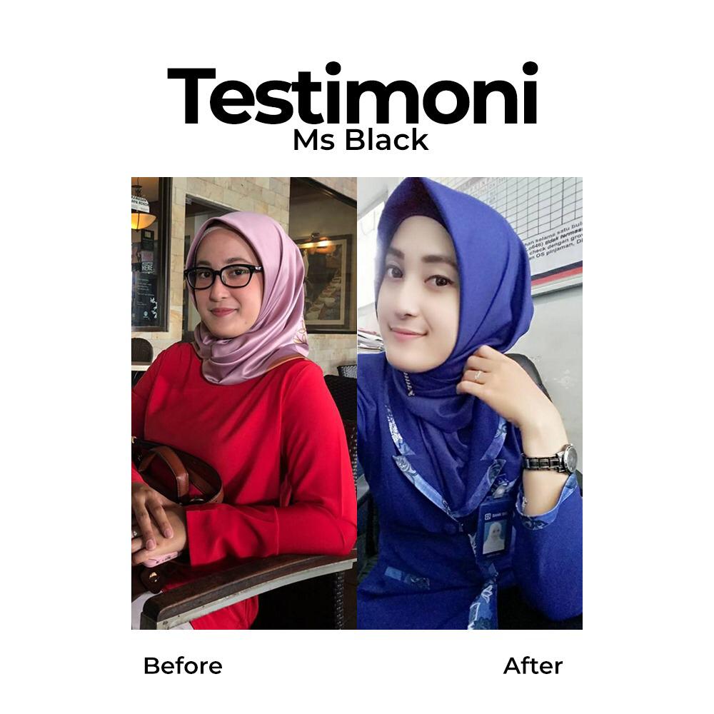 testimoni ms glow skin care