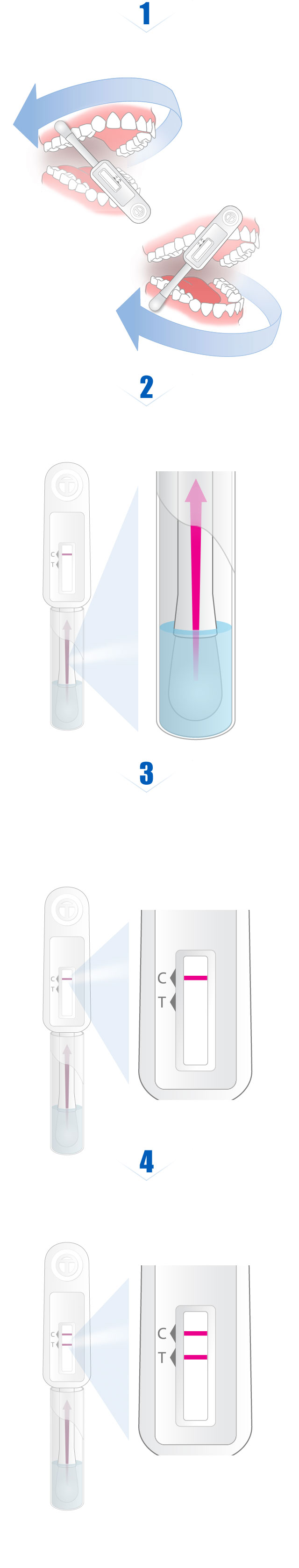 HIV/AIDS Home Testing Kit Called Oral FluidBased Rapid Diagnostic Test