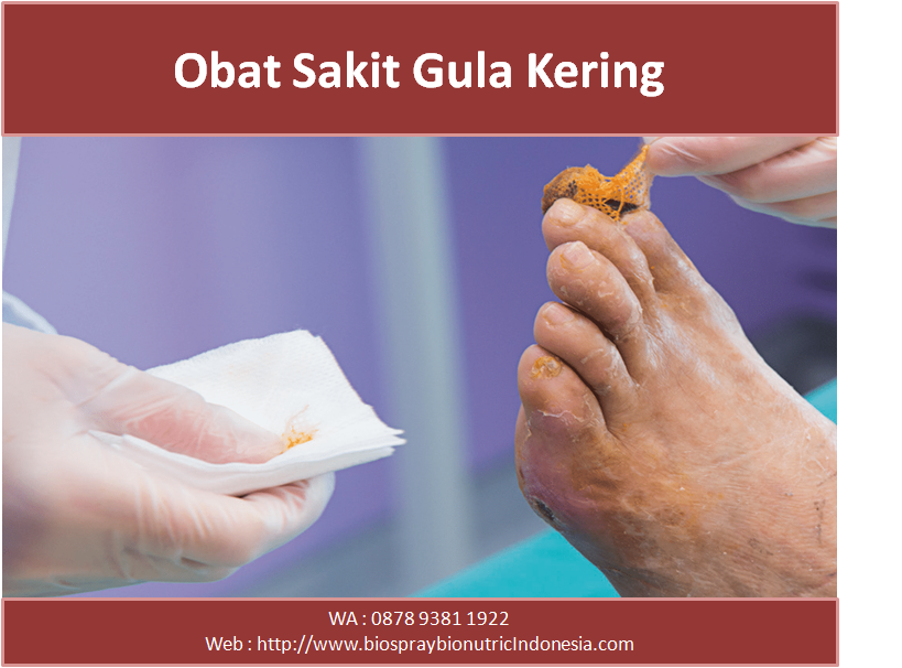 WA 0878-9381-1922, jual Obat herbal gula darah tinggi Di Medan ~ Obat