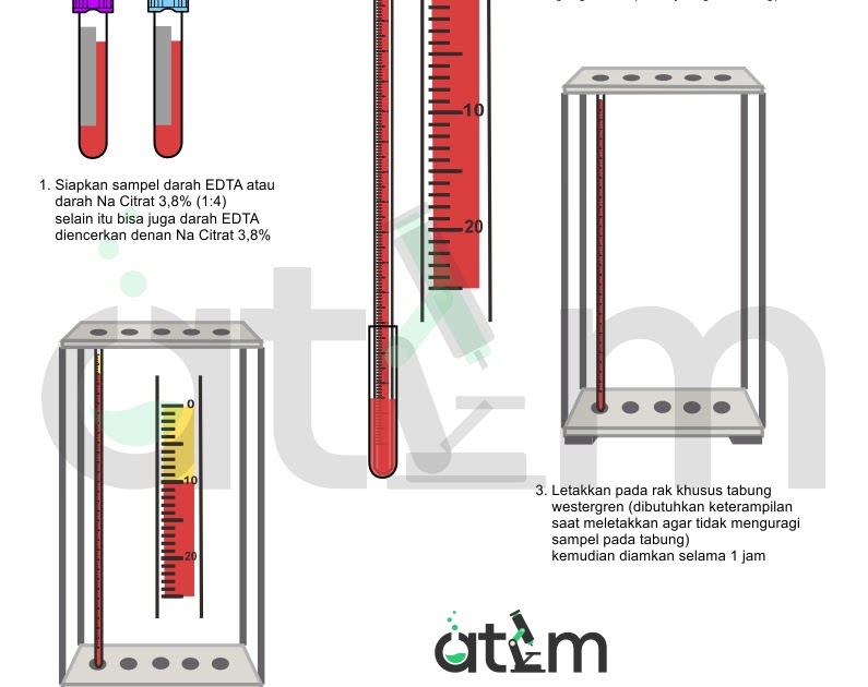 Pemeriksaan Laju Endap Darah (LED) Metode Westergren — Online Text Book ...