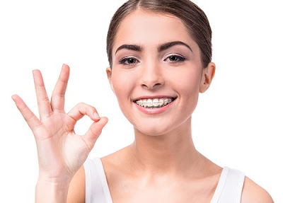 Chữa móm bằng niềng răng có hiệu quả không?