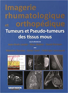 Imagerie Rhumatologique Et Orthopédique: Tumeurs Et Pseudo-tumeurs Des Tissus Mous 51bWxXMbDDL._SX365_BO1%252C204%252C203%252C200_