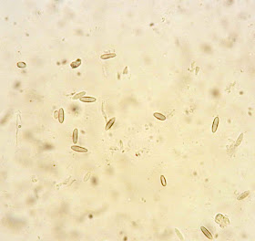 pale brown ellipsoid spores of Phaeocalicium polyporaeum