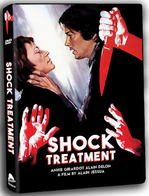 Shock Treatment 1973 Dvd