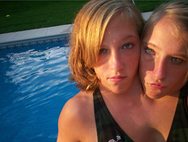 abby and brittany hensel conjoined twins where are they now