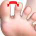 LOOK CLOSELY AT THE SPACE BETWEEN THE TOES – THIS COULD SAVE YOUR LIFE!
