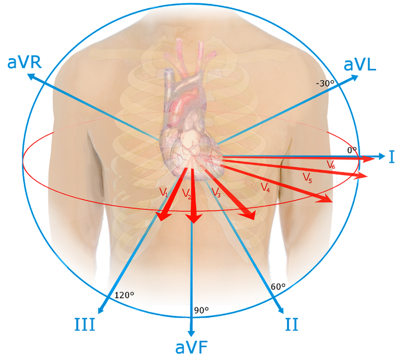 Anesthesiology Class note on ECG for Diploma Critical Care