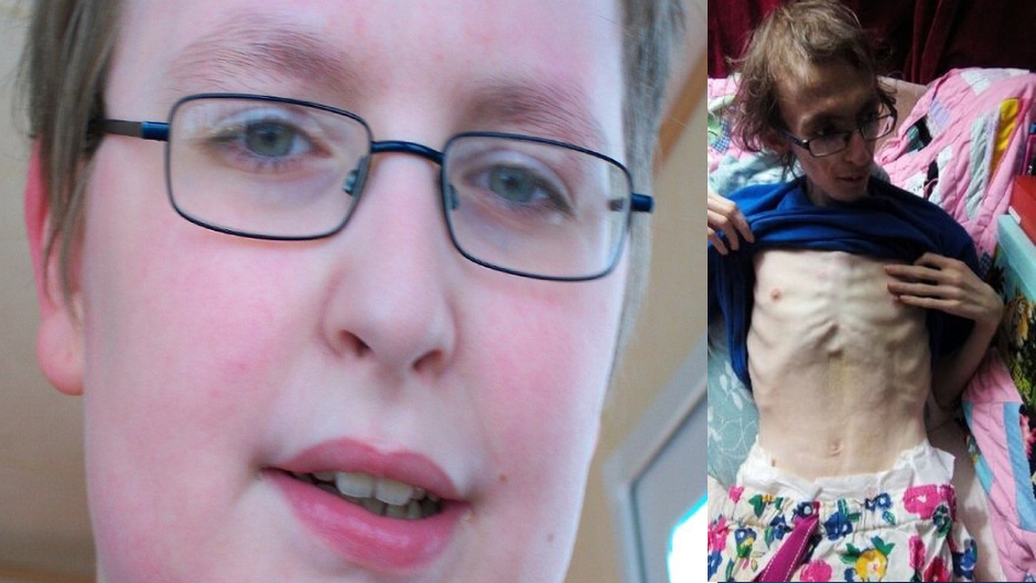 Killer mom serves 2 YEARS for starving teen son until he weighs less than 87 pounds Killer mom serves 2 YEARS for starving teen son until he weighs less than 87 pounds