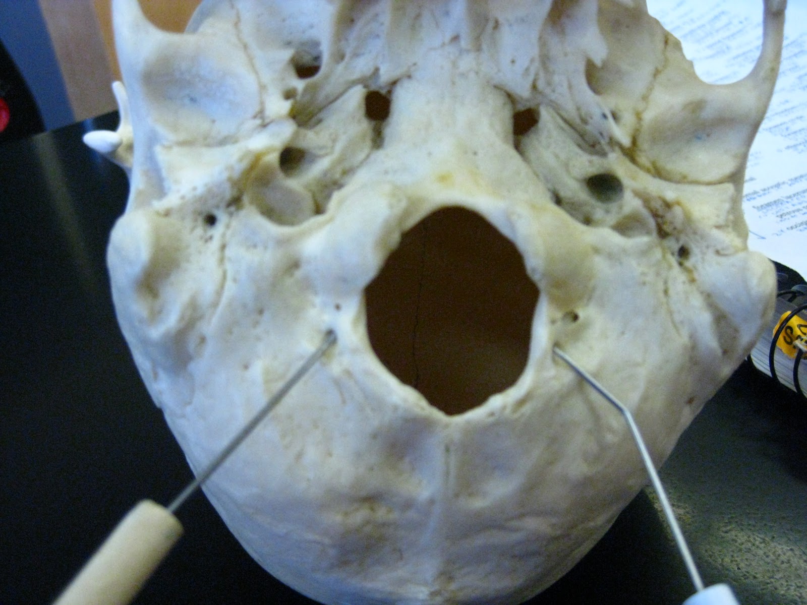 Boned: Human Skull - condyloid canal (of occipital bone)
