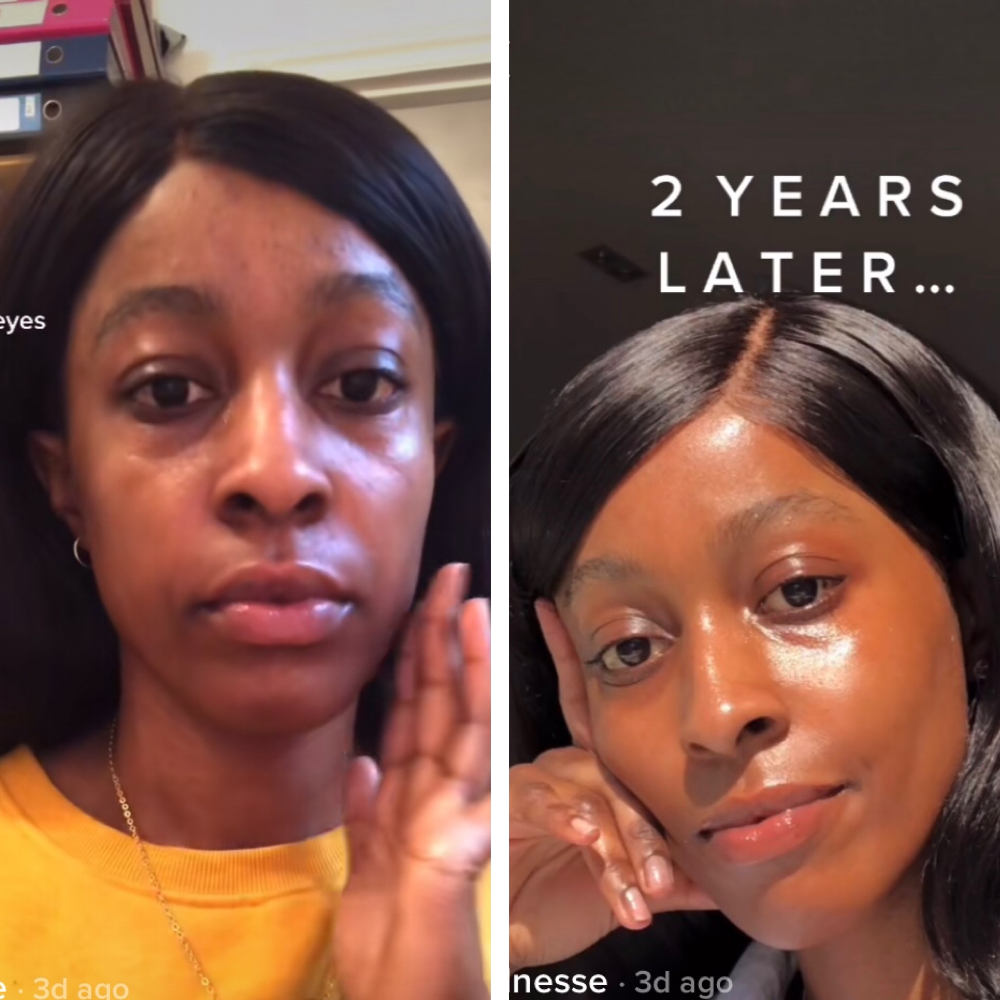 Prepare To Be Amazed: Faydwynn Morningstar'S Before & After Transformation - 4do7d9x