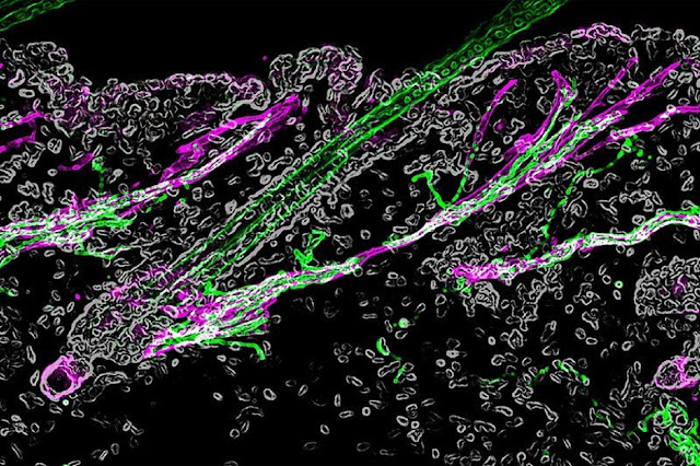 Волосяной фолликул, симпатический нерв (зеленый) и мышца (пурпурный) под микроскопом / © Гарвардский университет