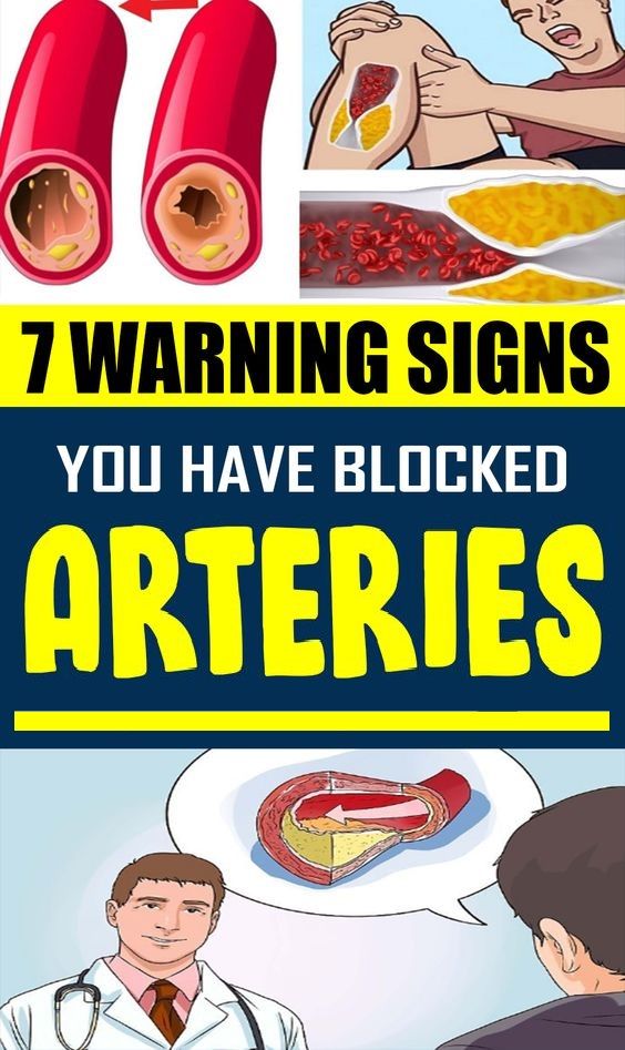 7 Warning Signs You Have Blocked Arteries mooseteaparty