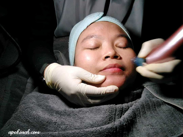 Buat Rawatan OxyPeel C Untuk Merawat Parut Di Dr Medispa & Wellness Buat Rawatan OxyPeel C Untuk Merawat Parut Di Dr Medispa & Wellness