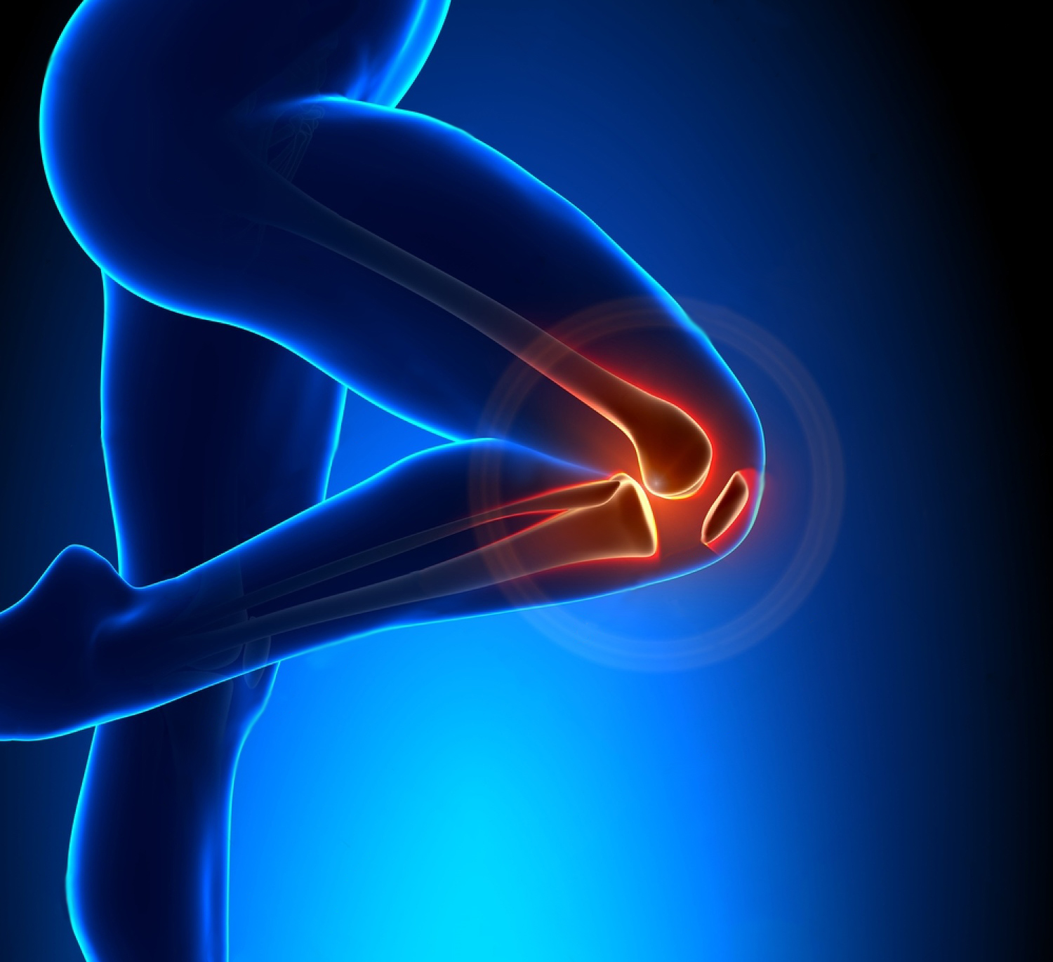Hyperextension Injuries The Knee