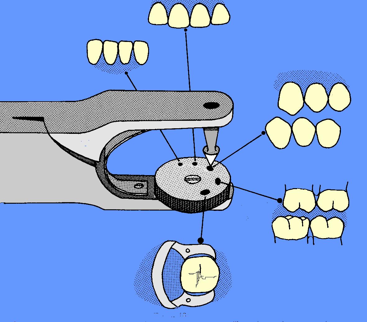 odonto legal: dentistica 1 (ISOLAMENTO DO CAMPO OPERATÓRIO)
