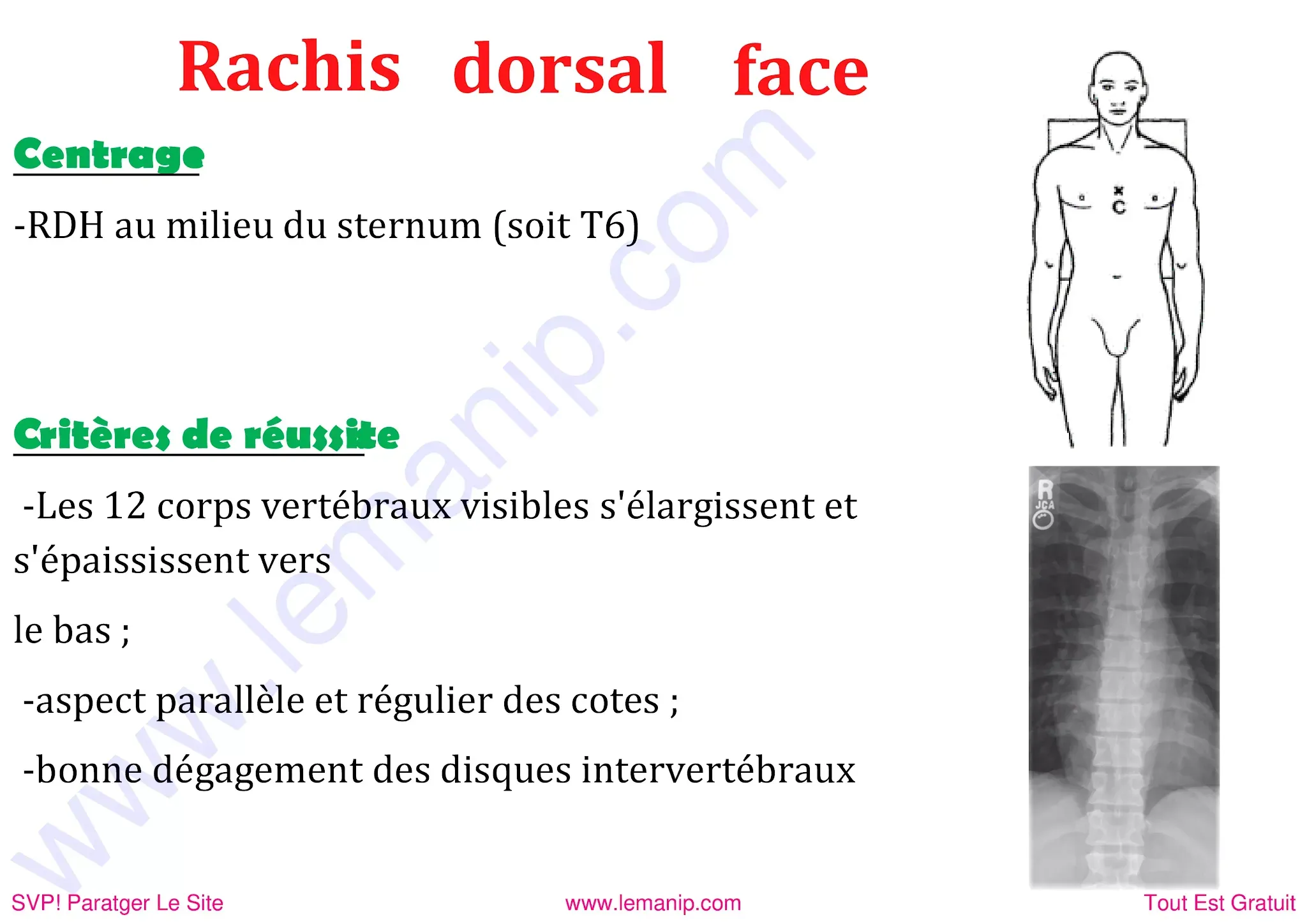 Rachis dorsale de face