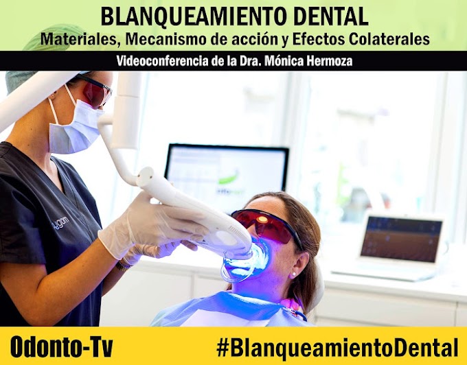 BLANQUEAMIENTO DENTAL: Materiales, Mecanismo de acción y Efectos Colaterales - Dra. Mónica Hermoza