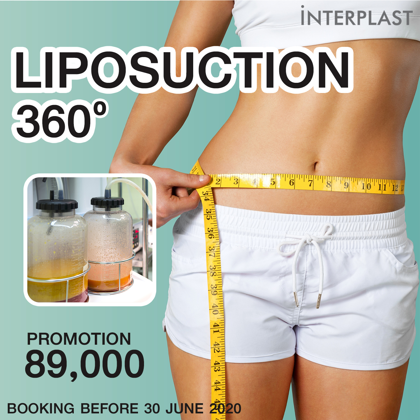 Interplast Clinic Liposuction 360 Degrees June 2020 Case Review Promo Offer!