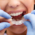 Niềng răng không mắc cài 3D Clear như thế nào?