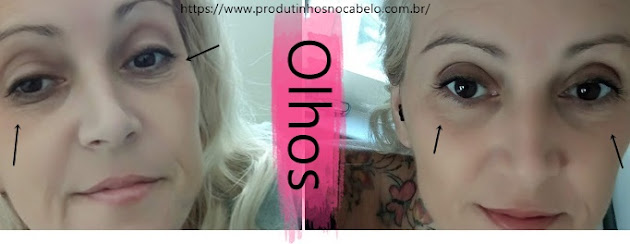 antes e depois Vichy Liftactiv Supreme Olhos