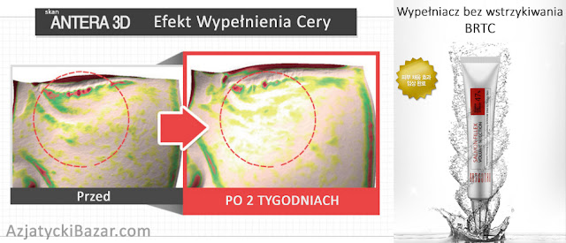 http://azjatyckibazar.com/kolekcja/frontpage/wypelniacz-bez-wstrzykiwania-wersja-brtc