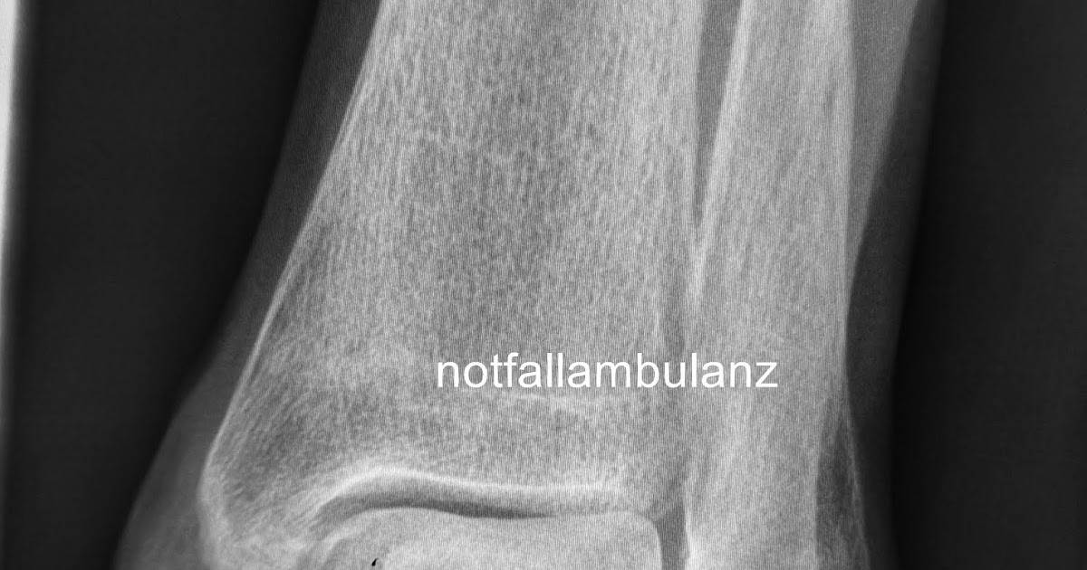 Brennpunkt Notaufnahme Fall 70 Eine einfache