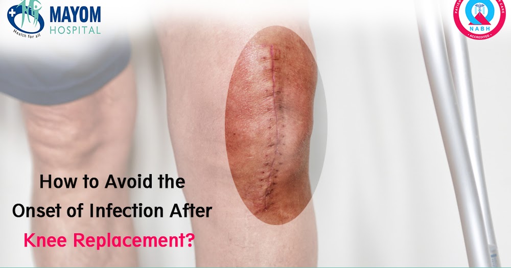 How to avoid the onset of infection after Knee Replacement?