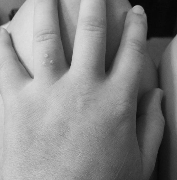 50+ White Ink Tattoos On Skin (2019) Pros & Cons Tattoo Ideas