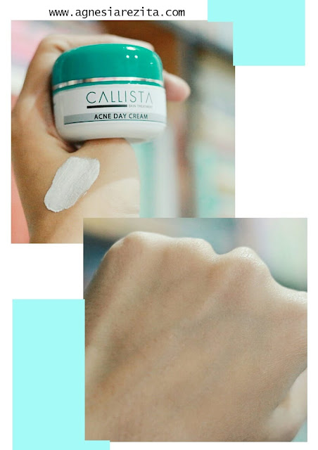 Callista Acne Day Cream