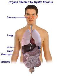 cystic-fibrosis-organs-affected
