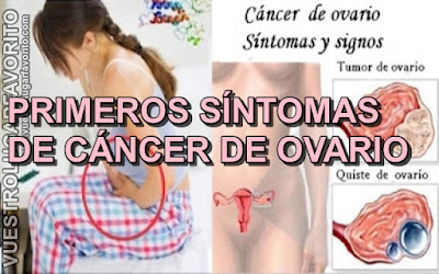 Sintomas de cancer de ano