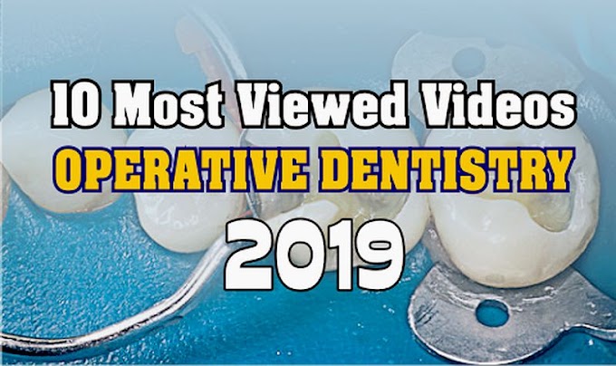 10 Most Viewed OPERATIVE DENTISTRY Videos in 2019