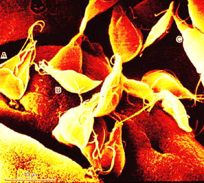 giardia hipertenzija