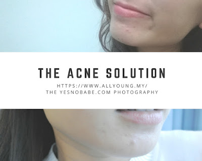 two picture with chin's acne